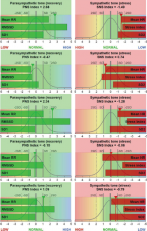 Primer prikaza natančne meritve frekvence srčnega utripa